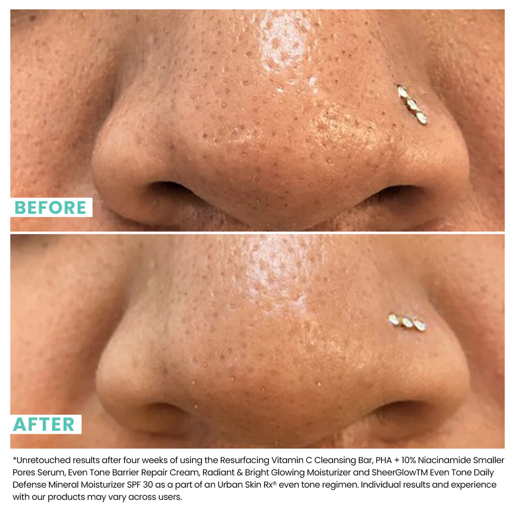 10% Niacinamide Oil Control & Smoothing Serum