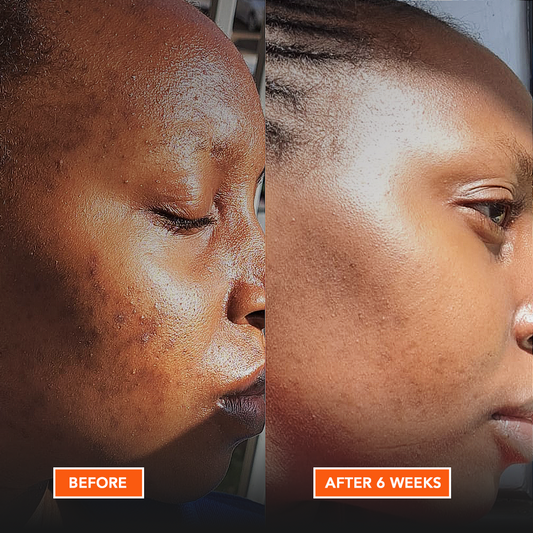 Uncover Licorice Root Dark Spot Serum