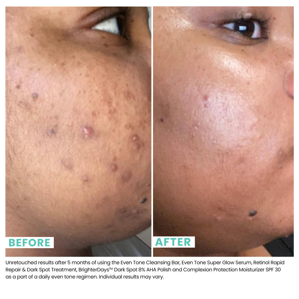 Even Tone Super Glow Serum