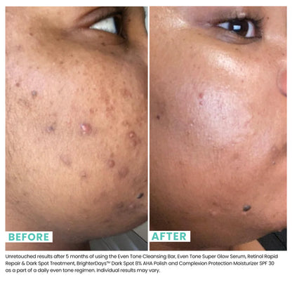 Even Tone Super Glow Serum